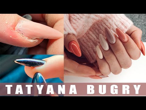 Видео: ОШИБКИ В РАБОТЕ Другого Мастера/ СЛОЖНАЯ КОРРЕКЦИЯ НОГТЕЙ/ Татьяна Бугрий