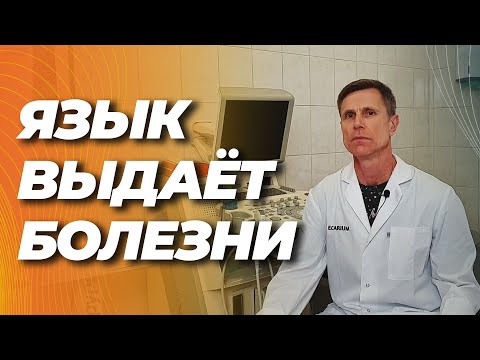 Видео: Что язык говорит о вашем здоровье