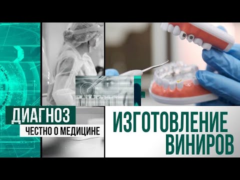 Видео: Как изготавливают виниры в цифровых зуботехнических лабораториях | Диагноз