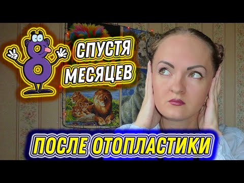 Видео: #99. Спустя 8 месяцев после ОТОПЛАСТИКИ. Почему я скрываю ЦЕНУ? Разные УШИ?! Ответы на ВАШИ ВОПРОСЫ