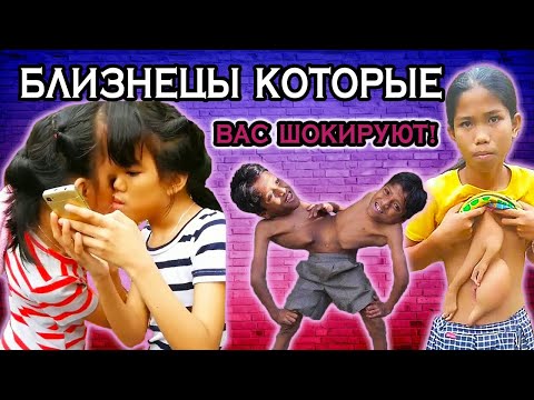 Видео: САМЫЕ НЕОБЫЧНЫЕ И СТРАННЫЕ БЛИЗНЕЦЫ СО ВСЕГО МИРА. Необычные и шокирующие люди.