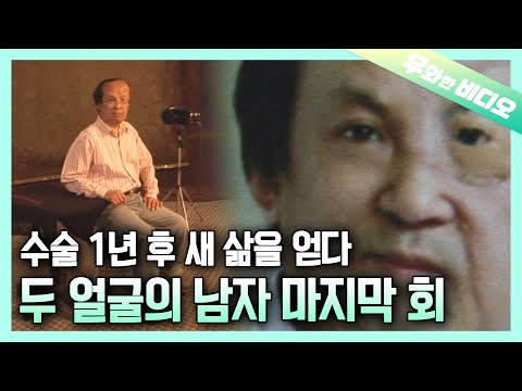 Видео: (Гл.3) Наконец-то вернул себе все лицо спустя 40 лет.