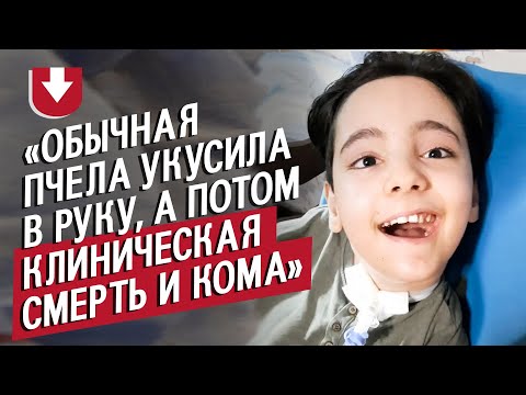 Видео: У сына была клиническая смерть после укуса пчелы: Аня | Быть мамой