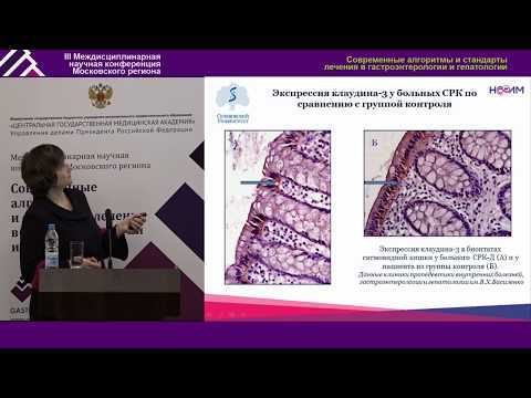 Видео: Лечение СРК, современное состояние проблемы