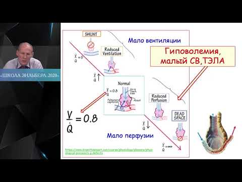 Видео: Инфузионная терапия  при ОРДС Мазурок В А