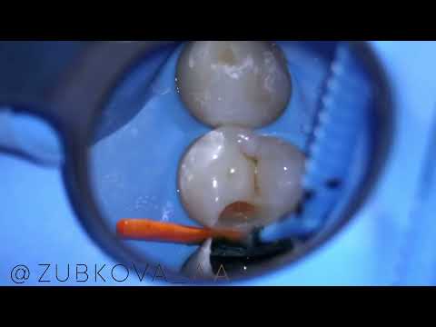 Видео: 2 этажа