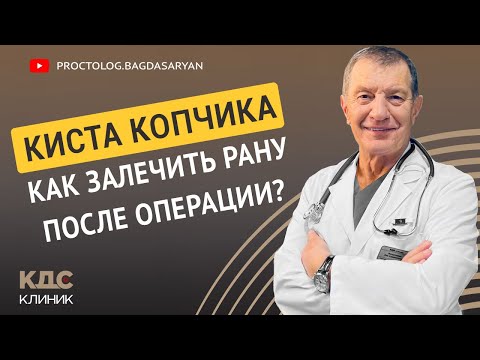 Видео: Киста копчика. Как залечить рану после удаления эпителиального копчикового хода (ЭКХ)?