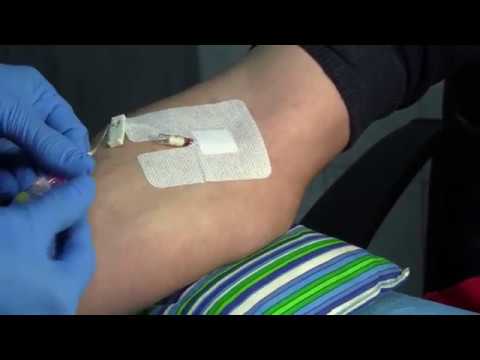 Видео: Установка периферической канюли "Ю-Флекс"