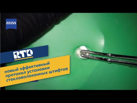 Видео: FRC – новый эффективный протокол установки стекловолоконных штифтов