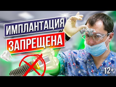 Видео: Кому и Почему запрещена ИМПЛАНТАЦИЯ ЗУБОВ [ Противопоказания к Имплантации Зубов ] Важно ⚠️