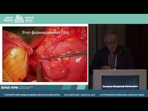 Видео: Важные «мелочи» гастропанкреатодуоденальной резекции (Загайнов В. Е.)