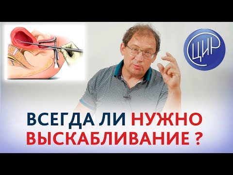 Видео: ВЫСКАБЛИВАНИЕ. Всегда ли нужно выскабливание при замершей беременности. Гузов И.И.