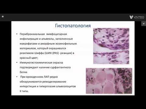 Видео: Гайнитдинова В.В. Альвеолярный протеиноз