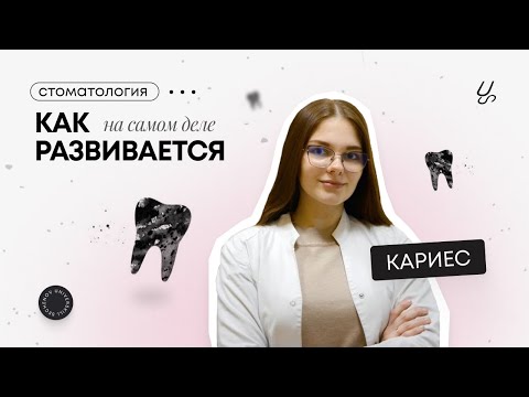 Видео: Как на самом деле развивается кариес?