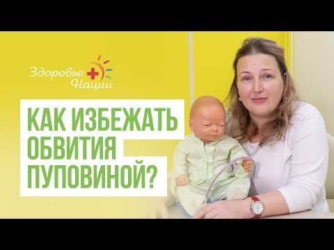 Видео: ОБВИТИЕ ПУПОВИНОЙ ВОКРУГ ШЕИ | Лариса Пульная |