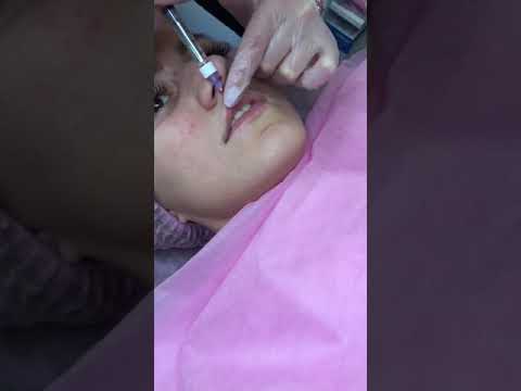 Видео: Губы бантик(4)