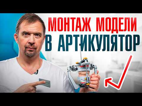 Видео: КАК СМОНТИРОВАТЬ МОДЕЛЬ ЗУБОВ В АРТИКУЛЯТОР: пошаговая инструкция