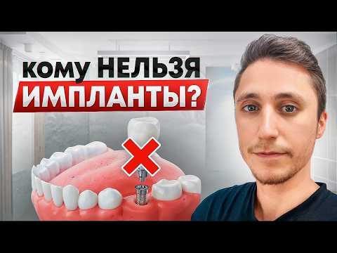 Видео: Кому ТОЧНО НЕЛЬЗЯ ставить зубные импланты? ВСЕ Противопоказания к имплантации зубов