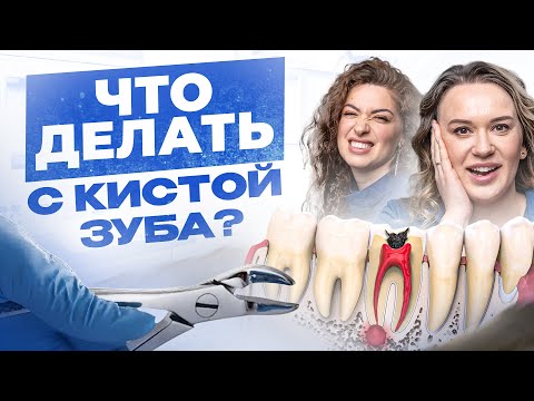 Видео: Удалять или лечить зубы с кистами? Отвечает хирург