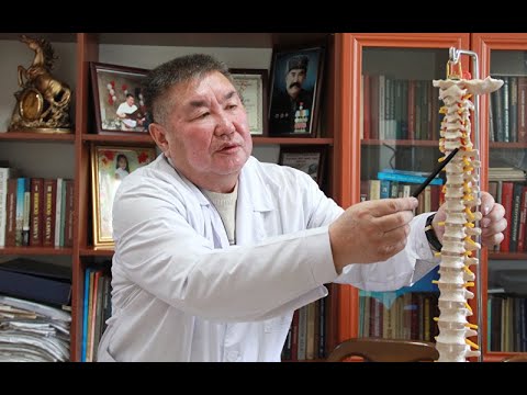 Видео: Т. БЕКБОЕВ, ВРАЧ: ОСТЕХОНДРОЗ ООРУСУН  ТОЛУК АЙЫКТЫРУУГА БОЛОТ. КОСТОПРАВДАР АДИС ЭМЕС, АЛАР СӨӨКТҮ.