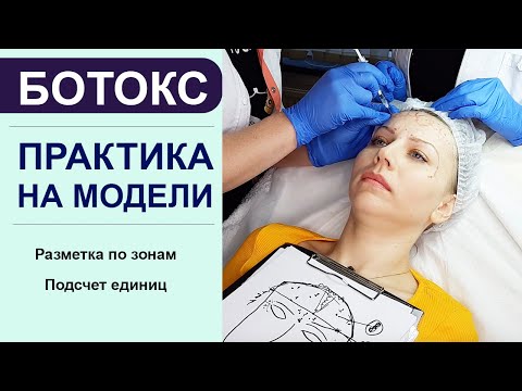 Видео: ПРАКТИКА ботокс на модели - разметка по зонам, подсчет единиц