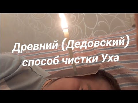 Видео: Древний способ чистки уха