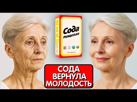 Видео: СОДА СТИРАЕТ 97 % МОРЩИН даже в 70 лет ! Все думали что она колет ботокс