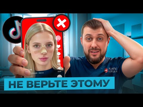 Видео: РИНОПЛАСТИКА. Мифы  в которые Верят : Восстановление, Результат, Советы