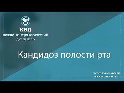 Видео: 857  Кандидоз полости рта