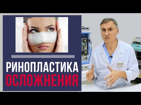 Видео: РИНОПЛАСТИКА: 🆘Осложнения | Чего бояться пациенту?