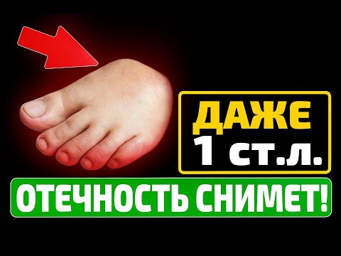 Видео: СТАРЫЙ ДОКТОР СПАС ЭТИМ СОВЕТОМ — КАК ИЗБАВИТЬСЯ ОТ ОТЁКОВ НОГ 🦵💧✨