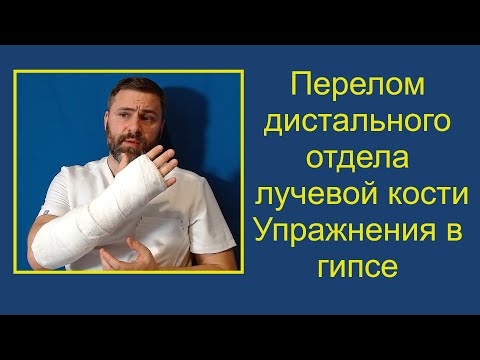 Видео: Перелом дистального отдела лучевой кости. Упражнения в гипсе.