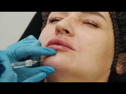 Видео: Устранение первых возрастных изменений с использованием филлеров Aliaxin (IBSA).