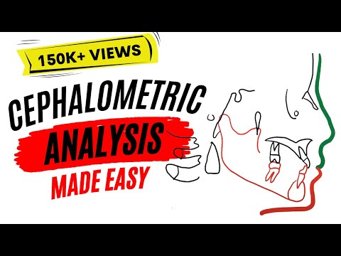 Видео: Цефалометрический анализ