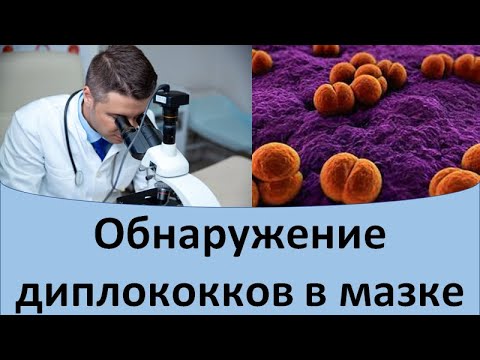 Видео: Обнаружение диплококков в мазке