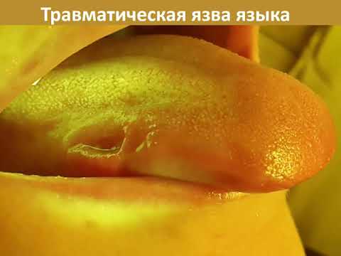 Видео: Онкологическая настороженность Практическое занятие