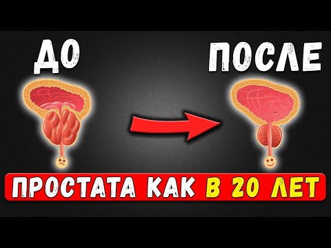 Видео: Мочеиспускание превращается в ПЫТКУ  СРОЧНО пейте это!