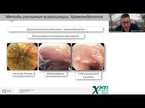 Видео: Пищевод Барретта: критерии диагностики, принципы ведения. Шишин К.В.