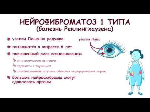 Видео: Нейрофиброматоз 1 и 2 типа