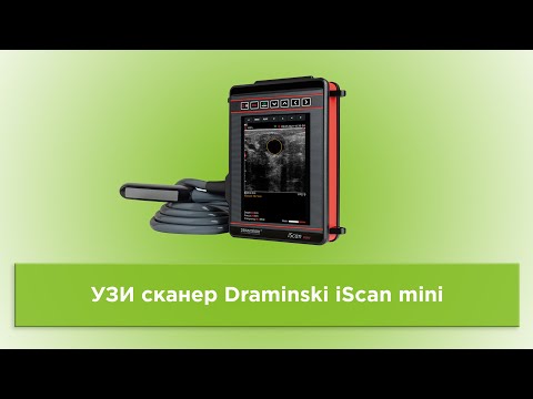 Видео: УЗИ сканер Draminski iScan mini