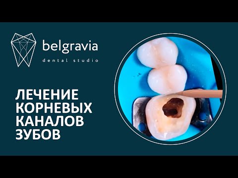 Видео: 👨‍⚕️ Лечение корневых каналов зубов