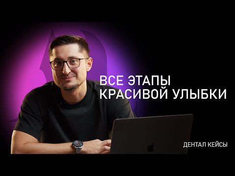 Видео: Все этапы красивой улыбки | Артур Лукьяненко | ДенталКейсы |