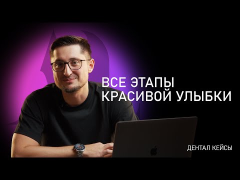 Видео: Все этапы красивой улыбки | Артур Лукьяненко | ДенталКейсы |