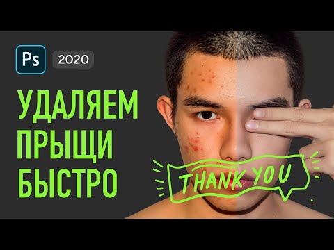 Видео: 🔥Как убрать прыщи в Фотошопе — 💯лучший способ удалить прыщи в Фотошоп