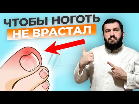 Видео: Вросший ноготь: вылечить быстро и навсегда!