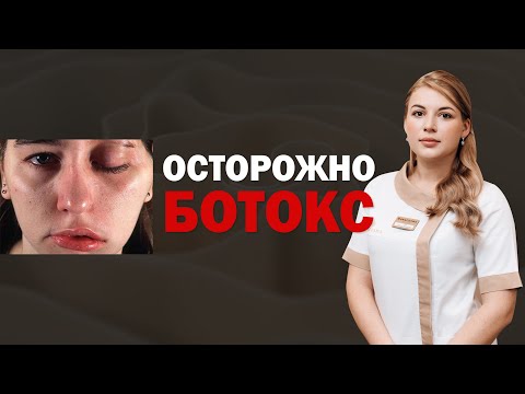 Видео: ОСЛОЖНЕНИЯ ПОСЛЕ БОТОКСА, ДИСПОРТ, КСЕОМИН ‼️💉 ПТОЗ ВЕК, ОПУЩЕНИЕ БРОВЕЙ ❌