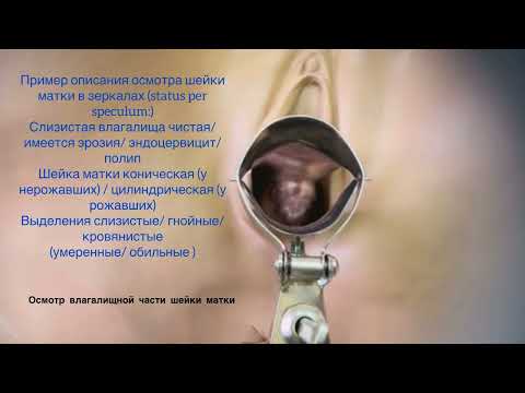 Видео: Осмотр шейки с помощью зеркал
