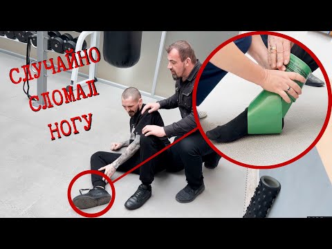 Видео: КАК СЛОМАТЬ и БЫСТРО ВЫЛЕЧИТЬ НОГУ