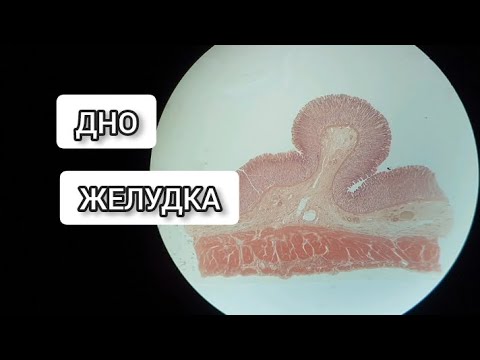 Видео: ДНО ЖЕЛУДКА