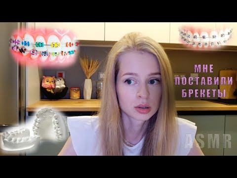 Видео: ПОСТАВИЛА БРЕКЕТЫ! 🦷 АСМР 🦷 Первые ощущения и боль! 🦷 Сколько стоят мои брекеты?